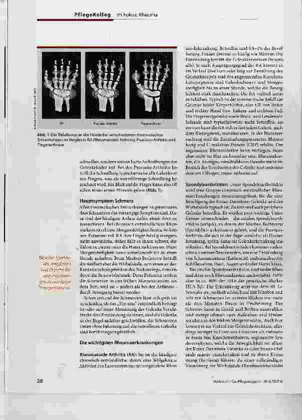 Vorschauseite 3: Rheumatische Erkrankungen unterscheiden lernen