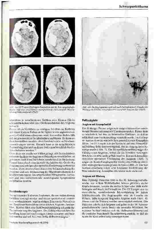 Vorschauseite 4: Angiome und Aneurysmen