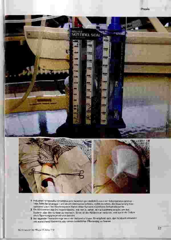 Vorschauseite 2: Thoraxdrainage: System mit Risiken