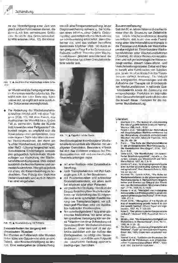 Vorschauseite 4: Die Rolle der Wachstumsfaktoren in der phasengerechten Wundversorgung Teil 3: Praktische Aspekte bei der Anwendung
