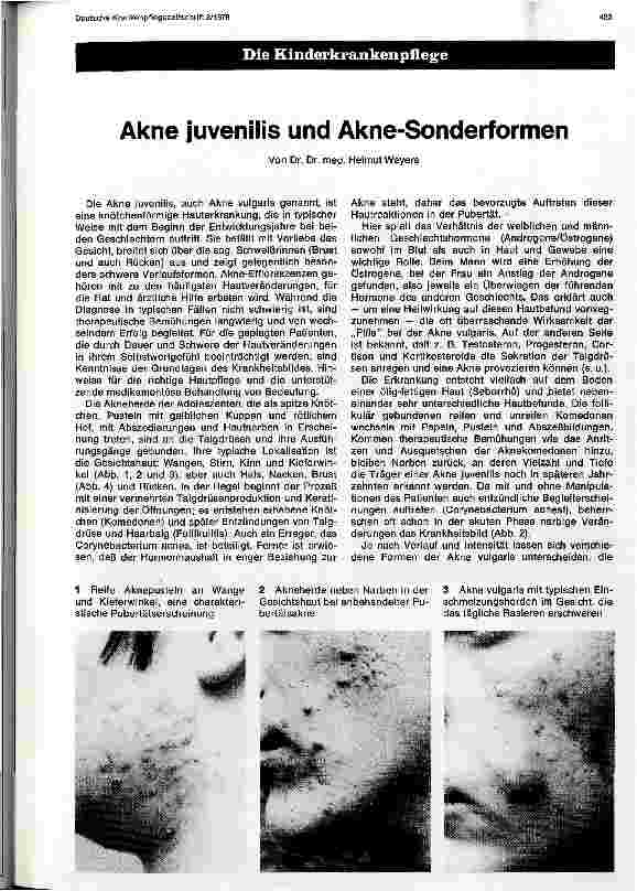 Vorschauseite 1: Akne juvenilis und Akne-Sonderformen