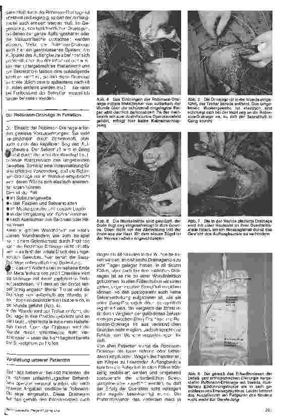 Vorschauseite 2: Modifizierte Robinson-Drainage für den Einsatz in der Unfallund orthopädischen Chirurgie
