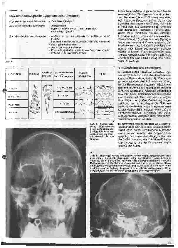 Vorschauseite 3: Themen aus der Neurochirurgie 11. Folge: Todeszeitbestimmung aus neurochirurgischer Sicht