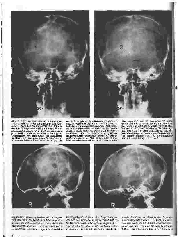 Vorschauseite 4: Themen aus der Neurochirurgie 11. Folge: Todeszeitbestimmung aus neurochirurgischer Sicht
