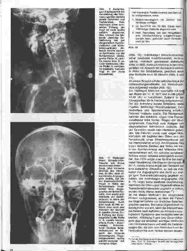 Vorschauseite 6: Themen aus der Neurochirurgie 11. Folge: Todeszeitbestimmung aus neurochirurgischer Sicht