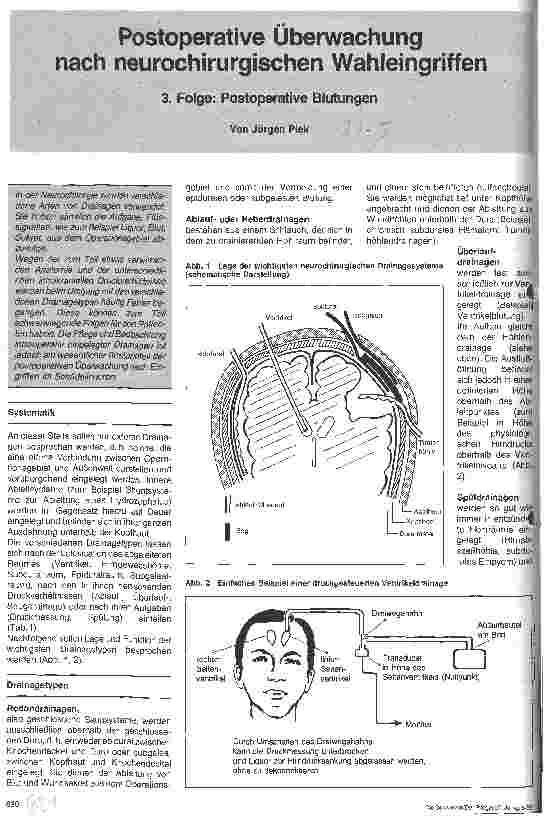 Vorschauseite 1: Postoperative Überwachung nach neurochirurgischen Wahleingriffen 3. Folge: Postoperative Blutungen