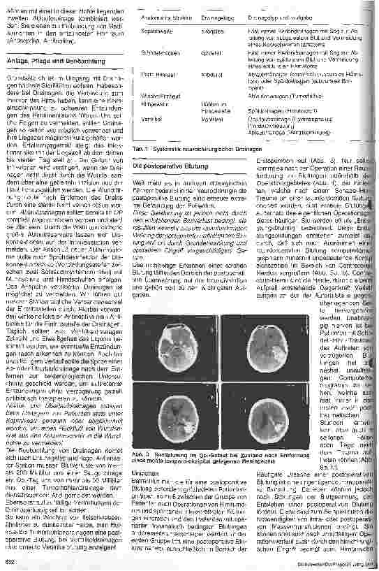 Vorschauseite 2: Postoperative Überwachung nach neurochirurgischen Wahleingriffen 3. Folge: Postoperative Blutungen