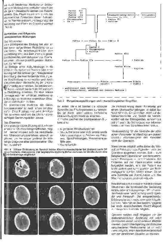 Vorschauseite 3: Postoperative Überwachung nach neurochirurgischen Wahleingriffen 3. Folge: Postoperative Blutungen