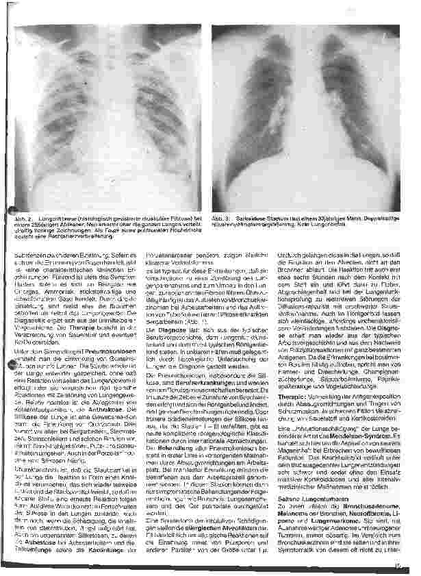Vorschauseite 2: Aktuelle Themen aus der Pneumologie 6. Folge: Seltene Lungenerkrankungen