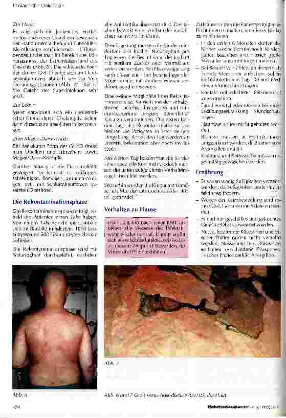 Vorschauseite 5: Knochenmarktransplantation / Stammzellentransplantation im Kindesalter Allgemeiner Ablauf und pflegerische Maßnahmen