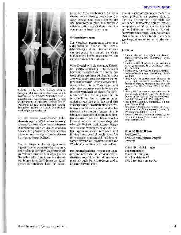 Vorschauseite 4: Fixateur externe bei Korrekturoperationen und Arthrodesen