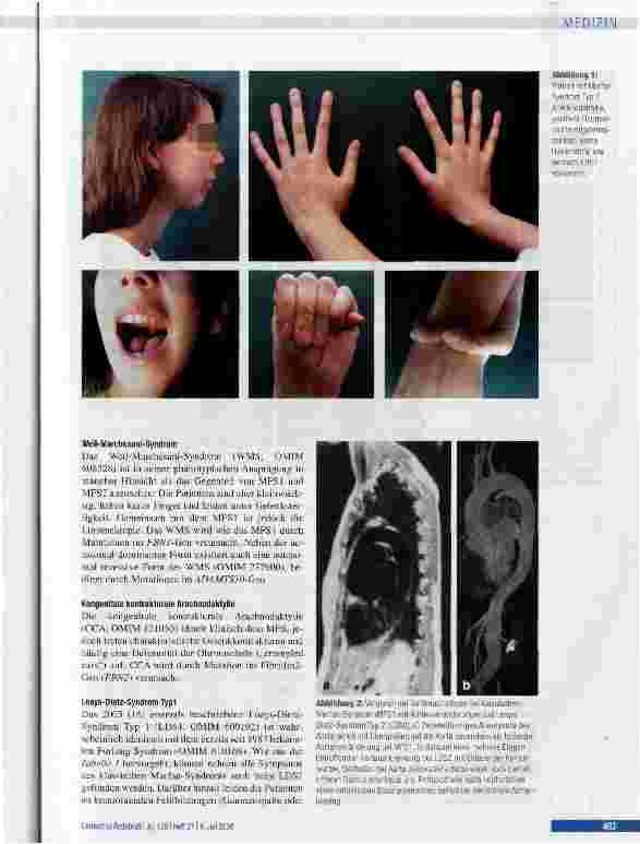 Vorschauseite 5: Genetische Diagnostik beim Marfan-Syndrom und verwandten ErkrankungenBedeutung des klinischen Managements