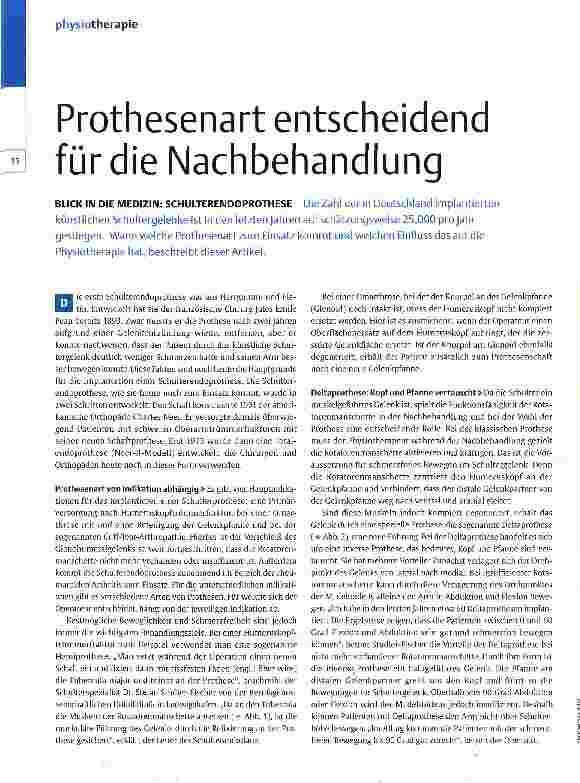 Vorschauseite 1: Prothesenart entscheidend für die Nachbehandlung