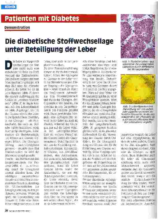 Vorschauseite 1: Die diabetische Stoffwechsellage unter Beteiligung der Leber