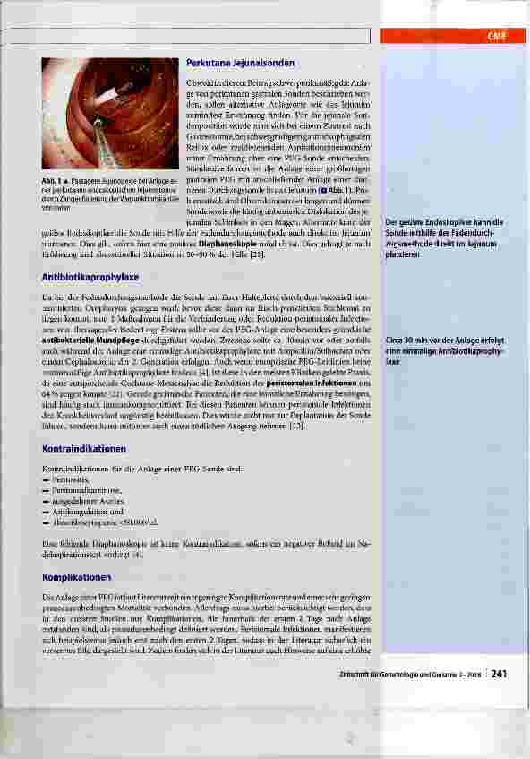 Vorschauseite 5: Die perkutane endoskopische Gastrostomie in der Altersmedizin