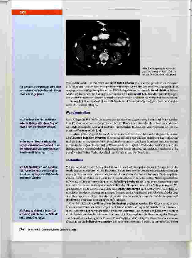 Vorschauseite 6: Die perkutane endoskopische Gastrostomie in der Altersmedizin