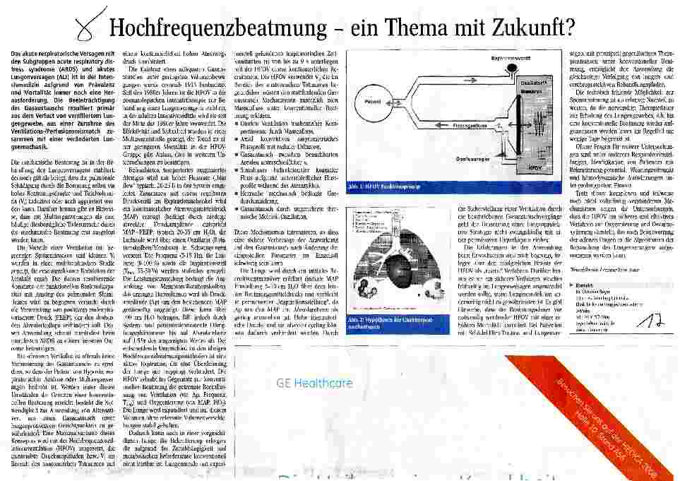 Vorschauseite 1: Hochfrequenzbeatmung - ein Thema mit Zukunft?