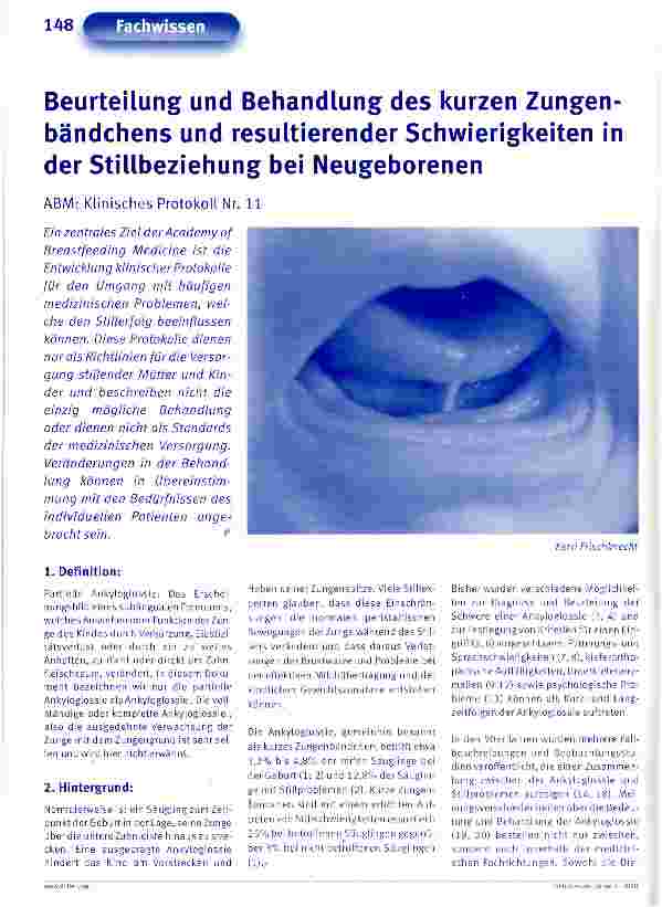 Vorschauseite 1: Beurteilung und Behandlung des kurzen Zungenbändchens und resultierender Schwierigkeiten in der Stillbeziehung bei Neugeborenen