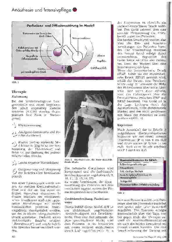 Vorschauseite 2: Bilevel Positive Airway Pressure über Nasenmaske Eine neue Atemtherapie für die Intensivmedizin