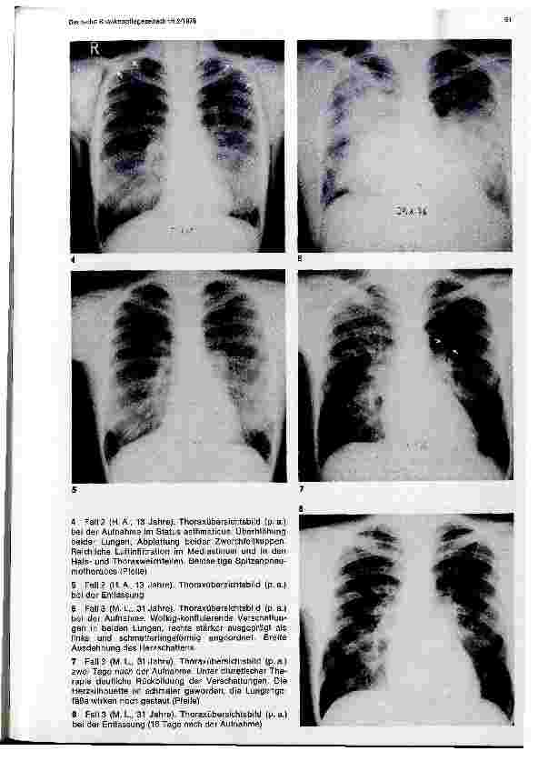 Vorschauseite 4: Der pulmonale Notfall