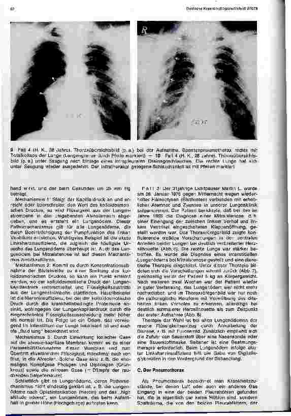 Vorschauseite 5: Der pulmonale Notfall