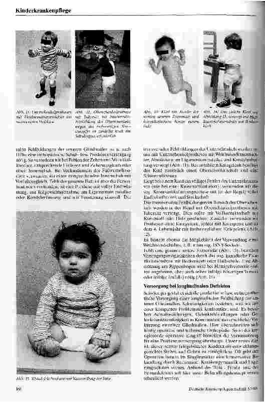 Vorschauseite 4: Prothetische Versorgung von Kindern mit Fehlbildungen der Extremitäten