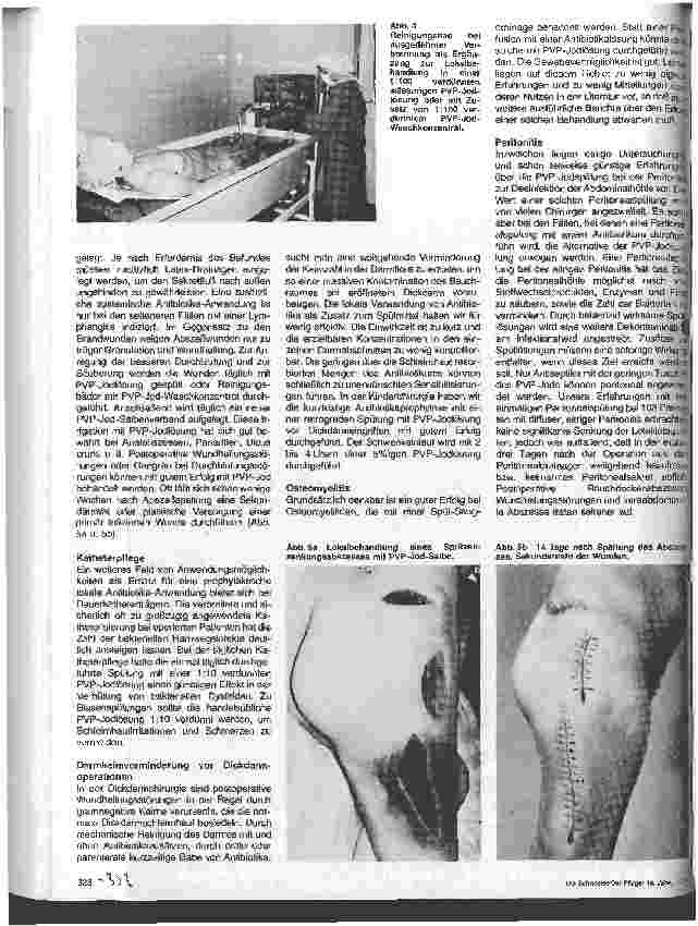 Vorschauseite 4: Möglichkeiten und Grenzen des Einsatzes von PVP-Jod in der Prophylaxe und Therapie von chirurgischen Infektionen