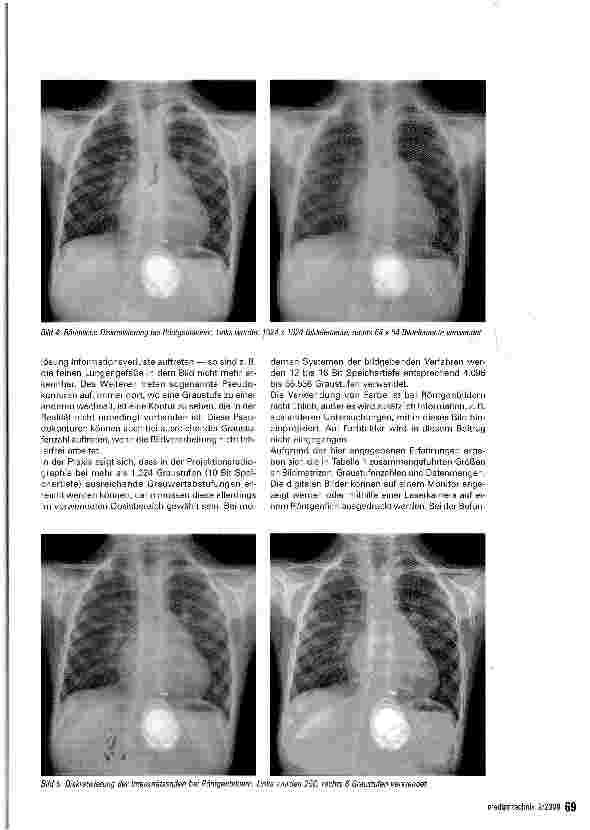 Vorschauseite 4: Bildverarbeitung in der Medizin - Teil 1