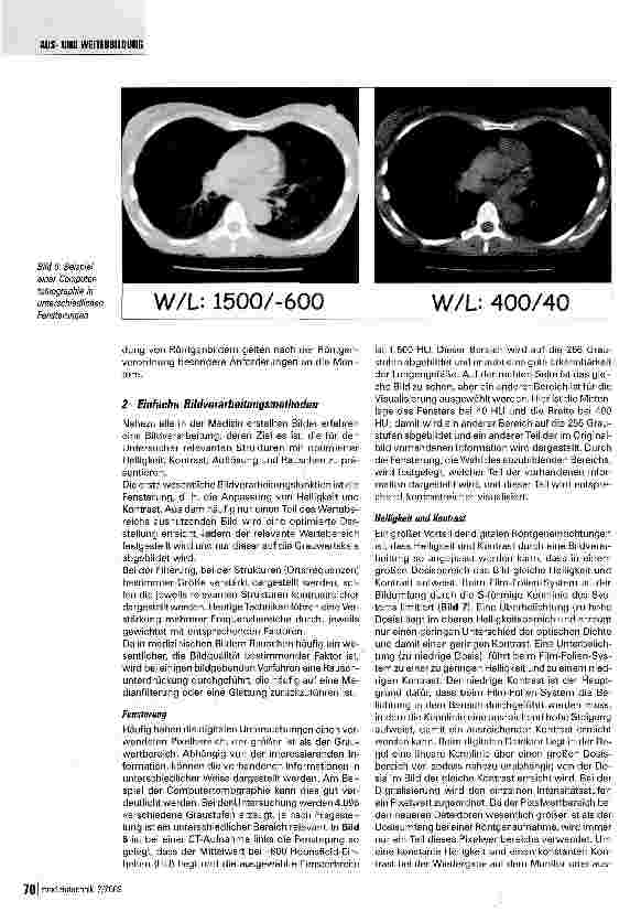 Vorschauseite 5: Bildverarbeitung in der Medizin - Teil 1