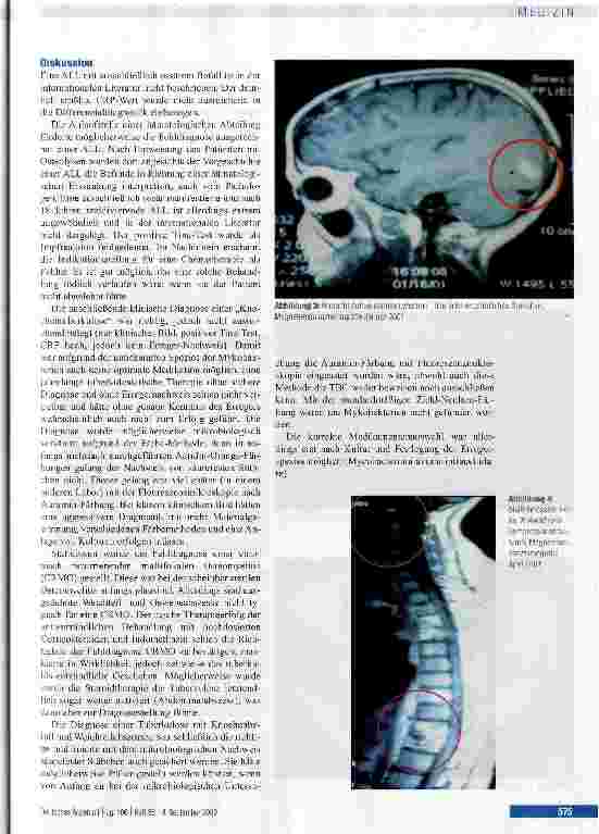 Vorschauseite 3: Gefährliche Fehler in Diagnostik und Therapie einer Knochentuberkulose