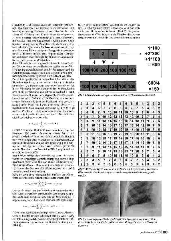 Vorschauseite 2: Bildverarbeitung in der Medizin - Teil 2