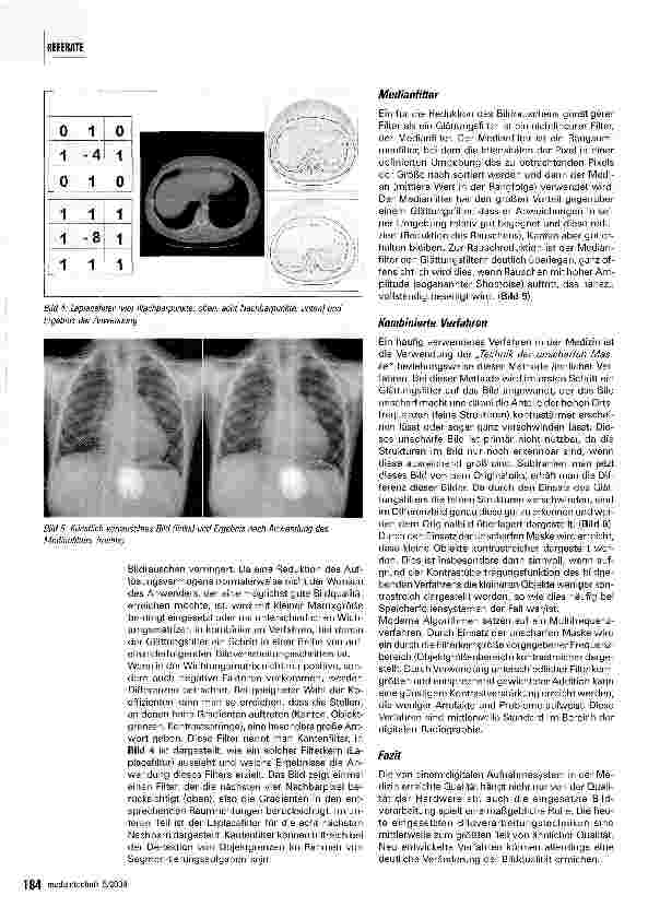 Vorschauseite 3: Bildverarbeitung in der Medizin - Teil 2