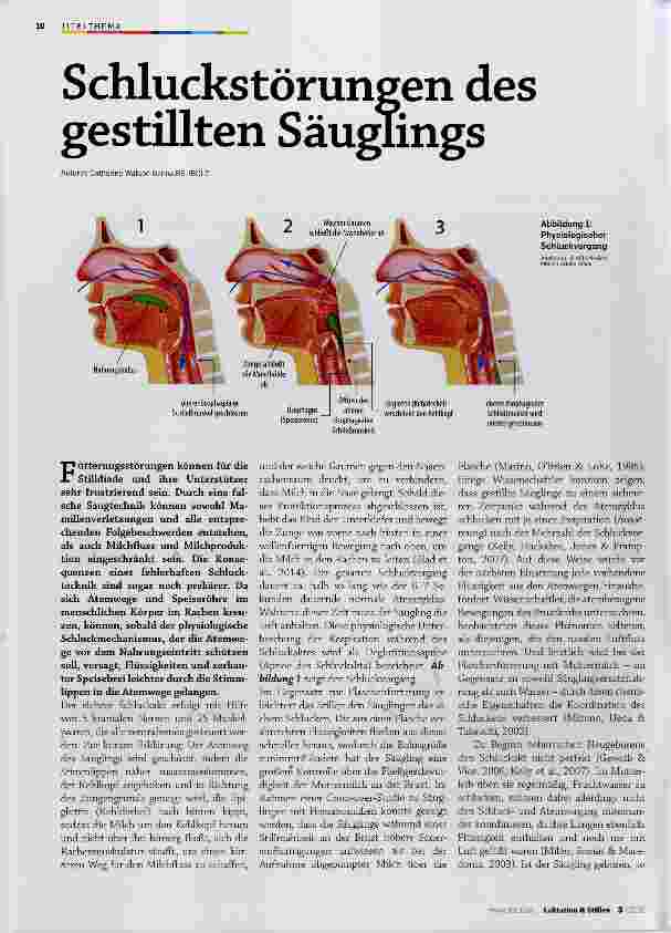 Vorschauseite 1: Schluckstörungen des gestillten Säuglings
