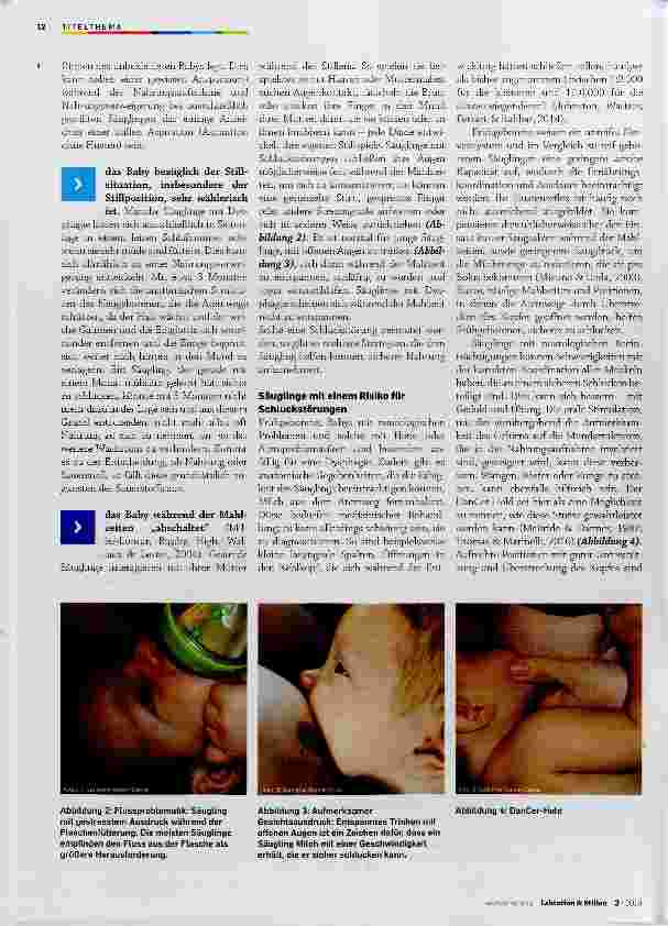 Vorschauseite 3: Schluckstörungen des gestillten Säuglings