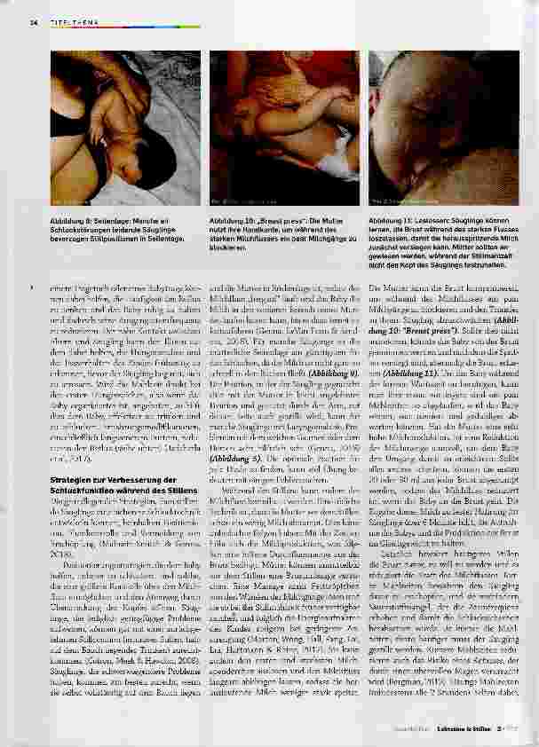 Vorschauseite 5: Schluckstörungen des gestillten Säuglings