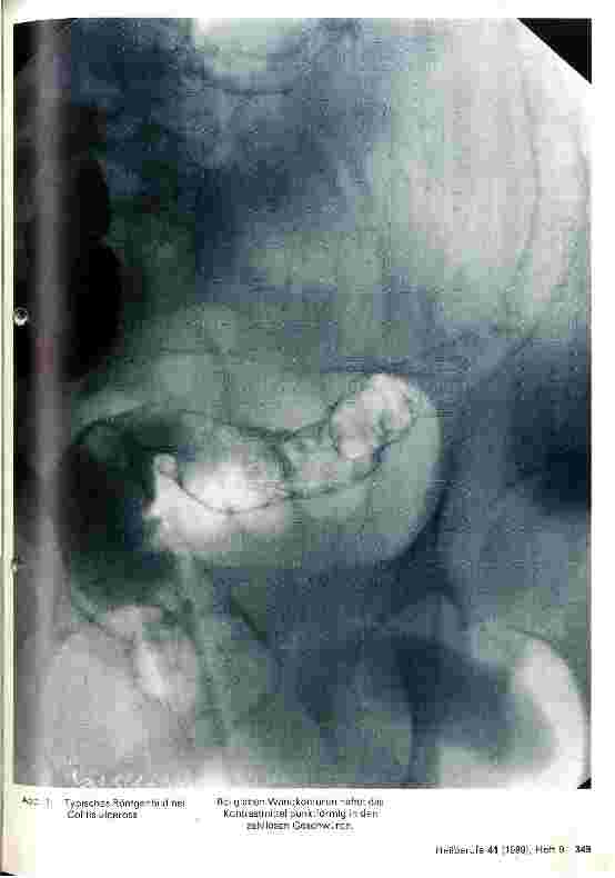 Vorschauseite 2: Pflege von Patienten mit Colitis ulcerosa