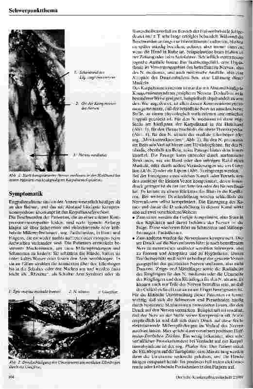 Vorschauseite 2: Kompressionssyndrome peripherer Nerven