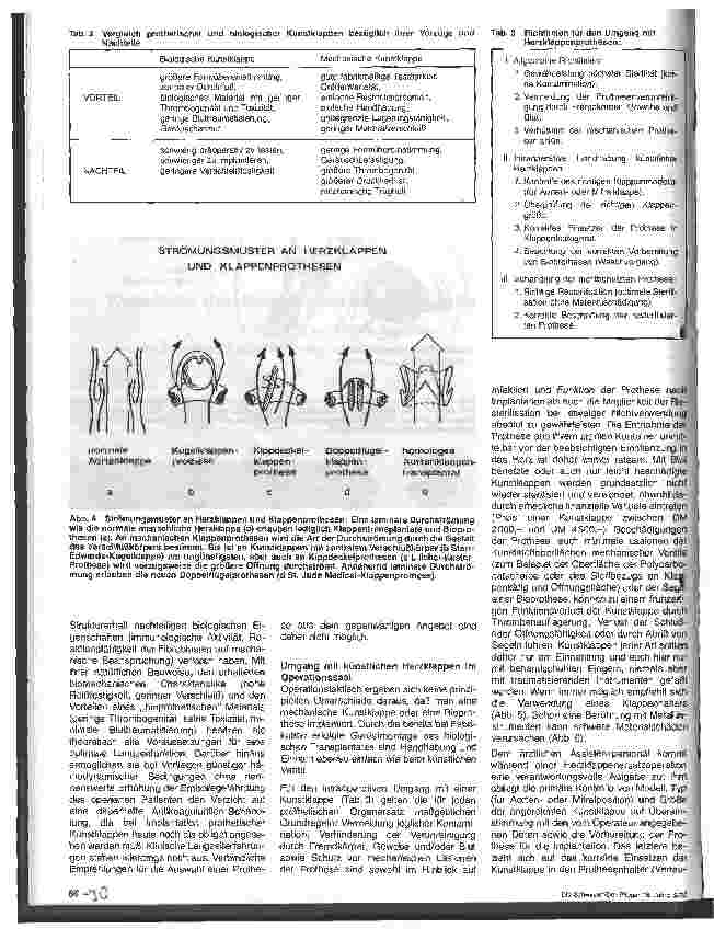 Vorschauseite 3: Künstliche Herzklappen und ihre Handhabung im Operationssaal