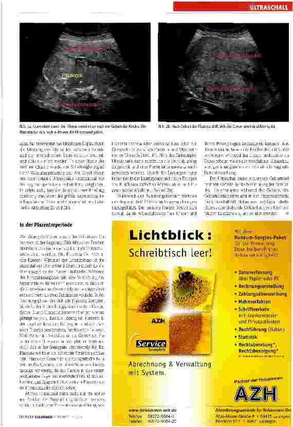 Vorschauseite 3: Ultraschall im Kreißsaal
