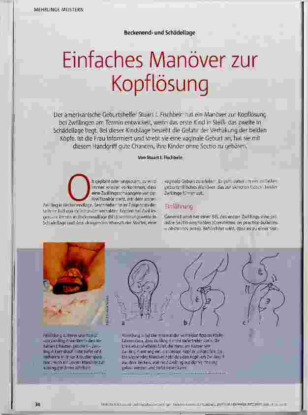 Vorschauseite 1: Einfaches Manöver zur Kopflösung