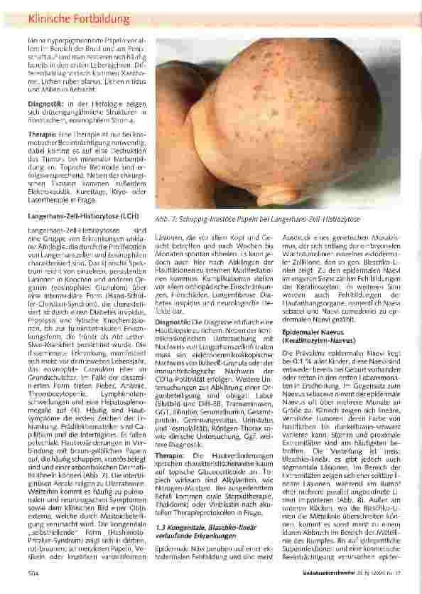 Vorschauseite 4: Differentialdiagnostik papulöser Hautveränderungen