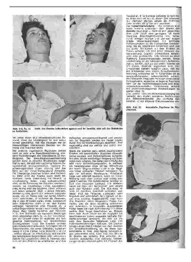 Vorschauseite 3: Die Schwester in der Psychiatrie 13. Folge: Die körperlich begründeten Psychosen