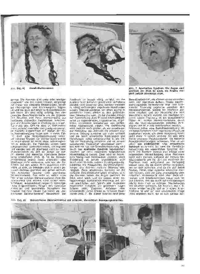 Vorschauseite 4: Die Schwester in der Psychiatrie 13. Folge: Die körperlich begründeten Psychosen