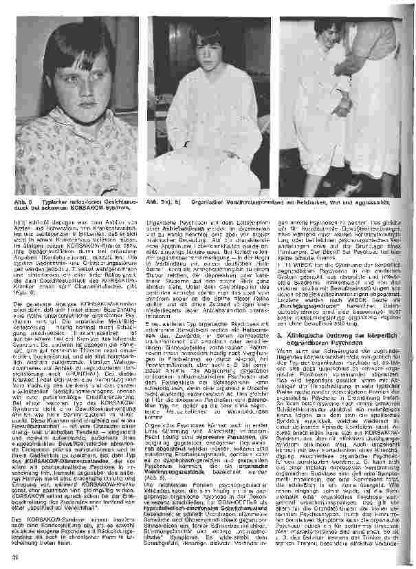 Vorschauseite 5: Die Schwester in der Psychiatrie 13. Folge: Die körperlich begründeten Psychosen