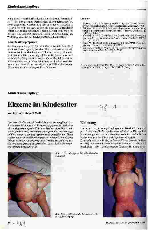 Vorschauseite 1: Ekzeme im Kindesalter
