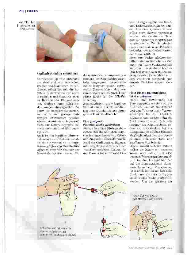 Vorschauseite 3: Einfach und sicher Blut entnehmen
