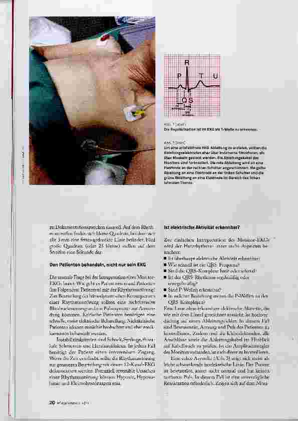 Vorschauseite 2: Herzrhythmusstörungen erkennen und beschreiben