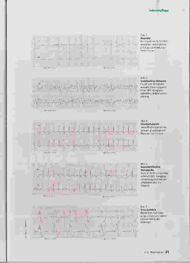 Vorschauseite 3: Herzrhythmusstörungen erkennen und beschreiben
