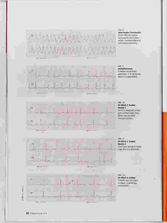 Vorschauseite 4: Herzrhythmusstörungen erkennen und beschreiben