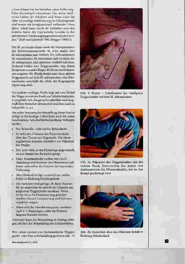 Vorschauseite 3: Das Infraspinatus-Syndrom